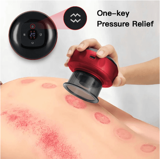 Electric Vacuum Cupping Massager - Glorious Skincare I Greater Chicago